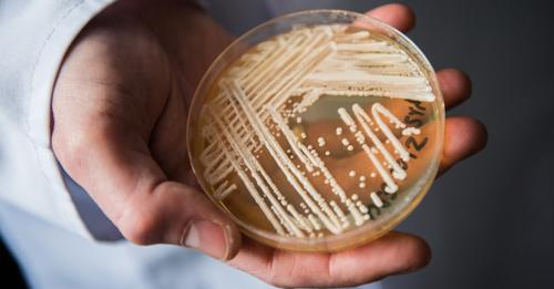 Deadly fungal infection spreading at an alarming rate, CDC says