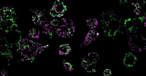 How obesity dismantles our mitochondria: Study reveals key mechanism behind obesity-related metabolic dysfunction